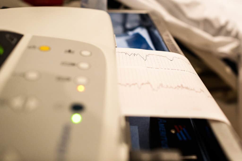 electrocardiogram medical device showing a patient 2024 10 18 08 59 37 utc